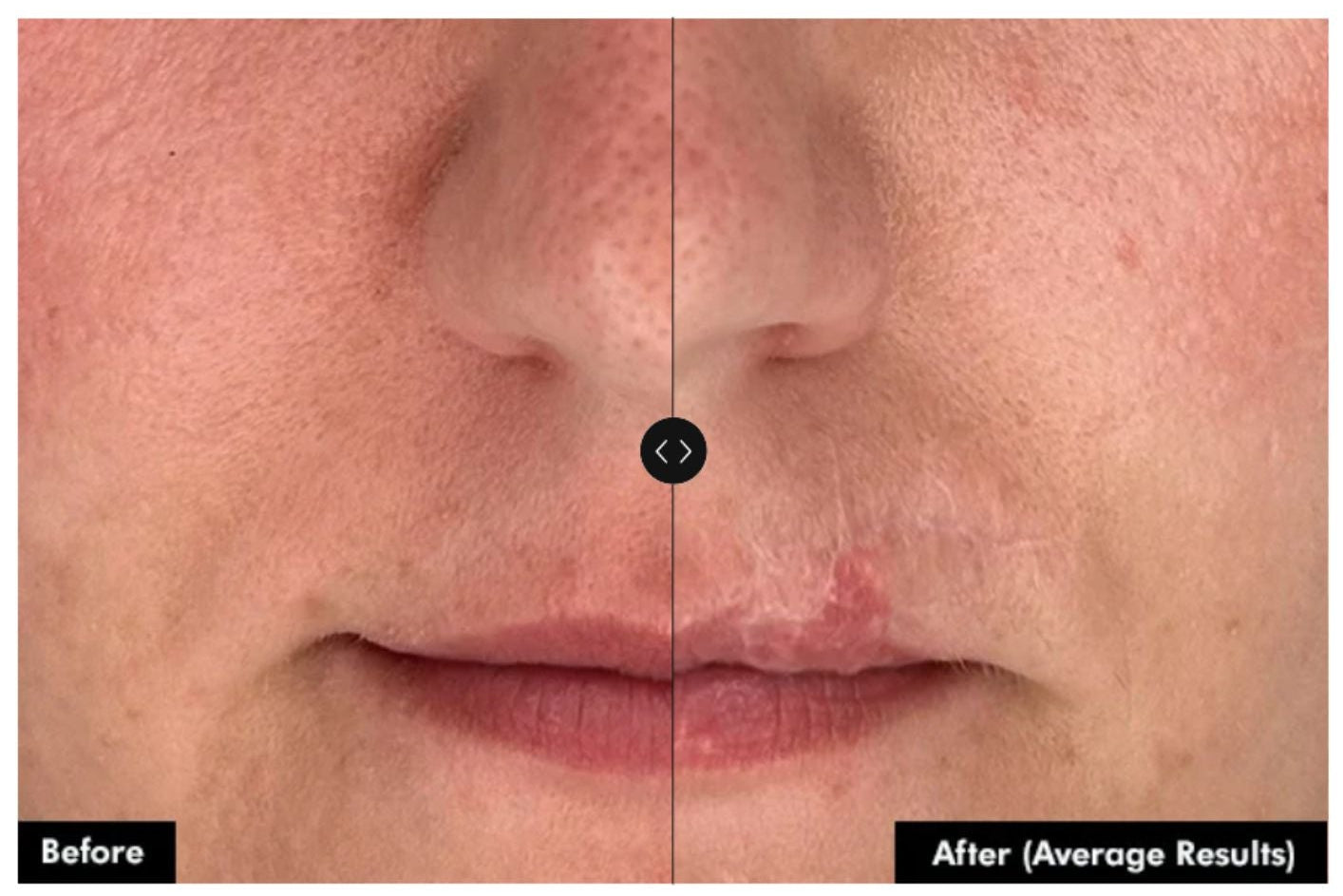 Skinceuticals Clear Daily Soothing UV Defense Sunscreen SPF 50
