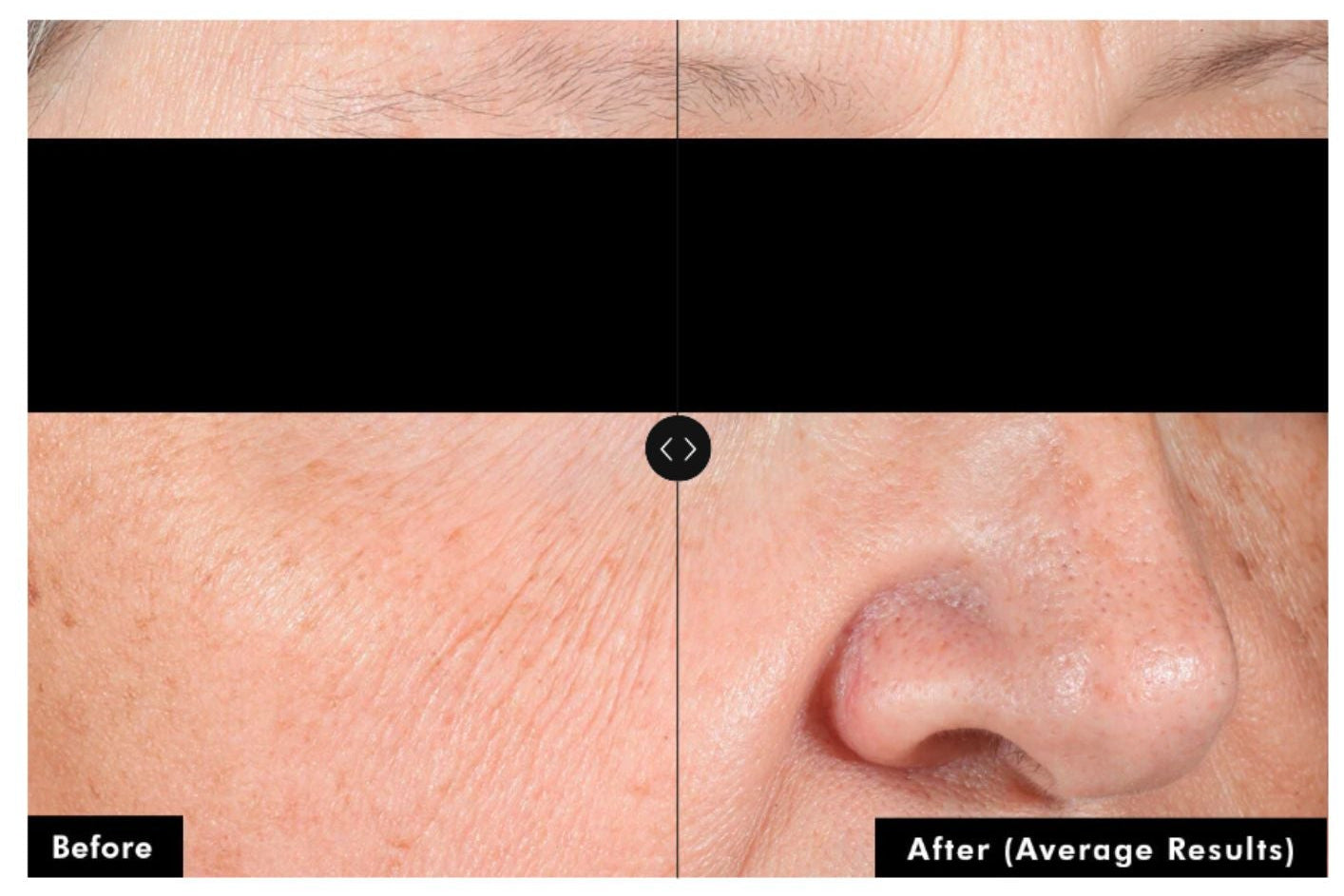 Skinceuticals A.G.E. Advanced Eye