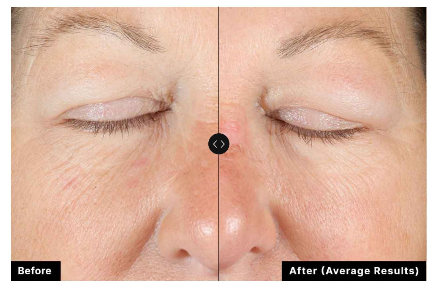 Skinceuticals A.G.E. Interrupter Advanced