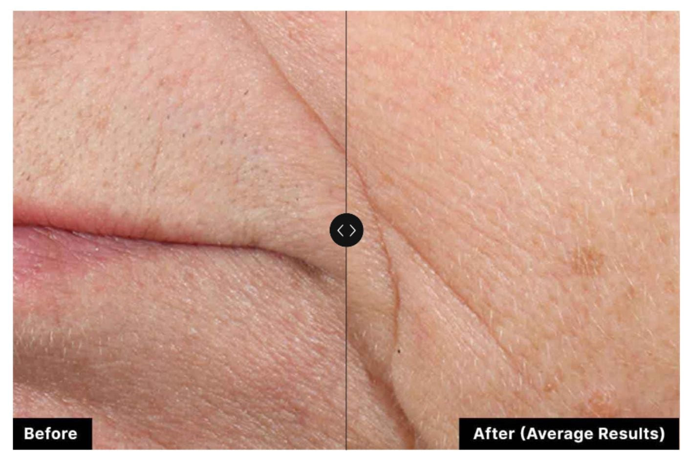 Skinceuticals Triple Lipid Restore 2:4:2