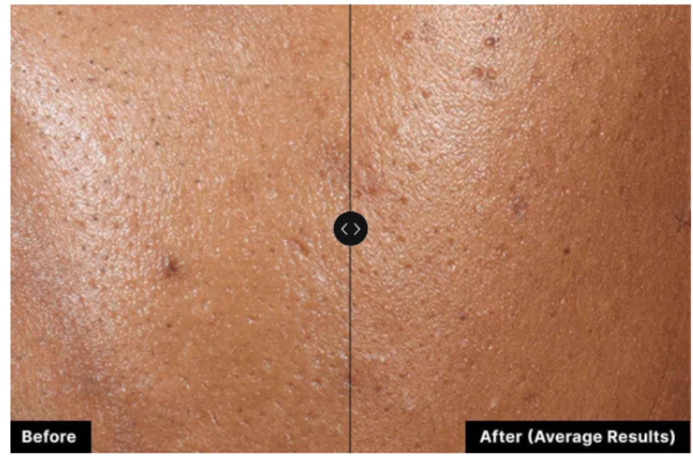Skinceuticals Phyto A+ Brightening Treatment