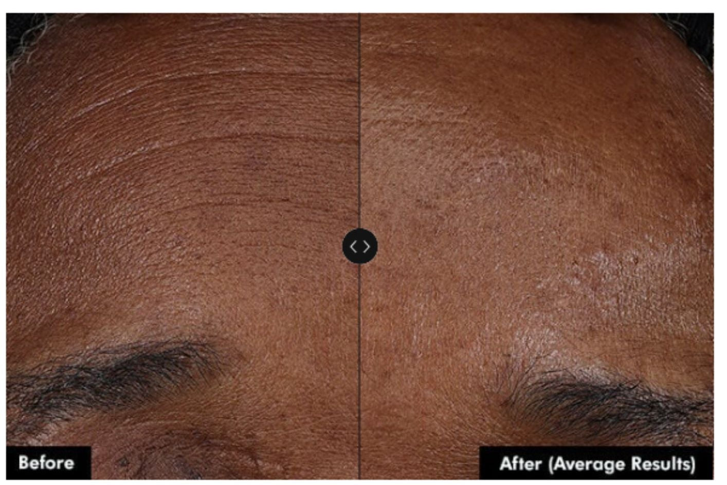 Skinceuticals P-Tiox Serum