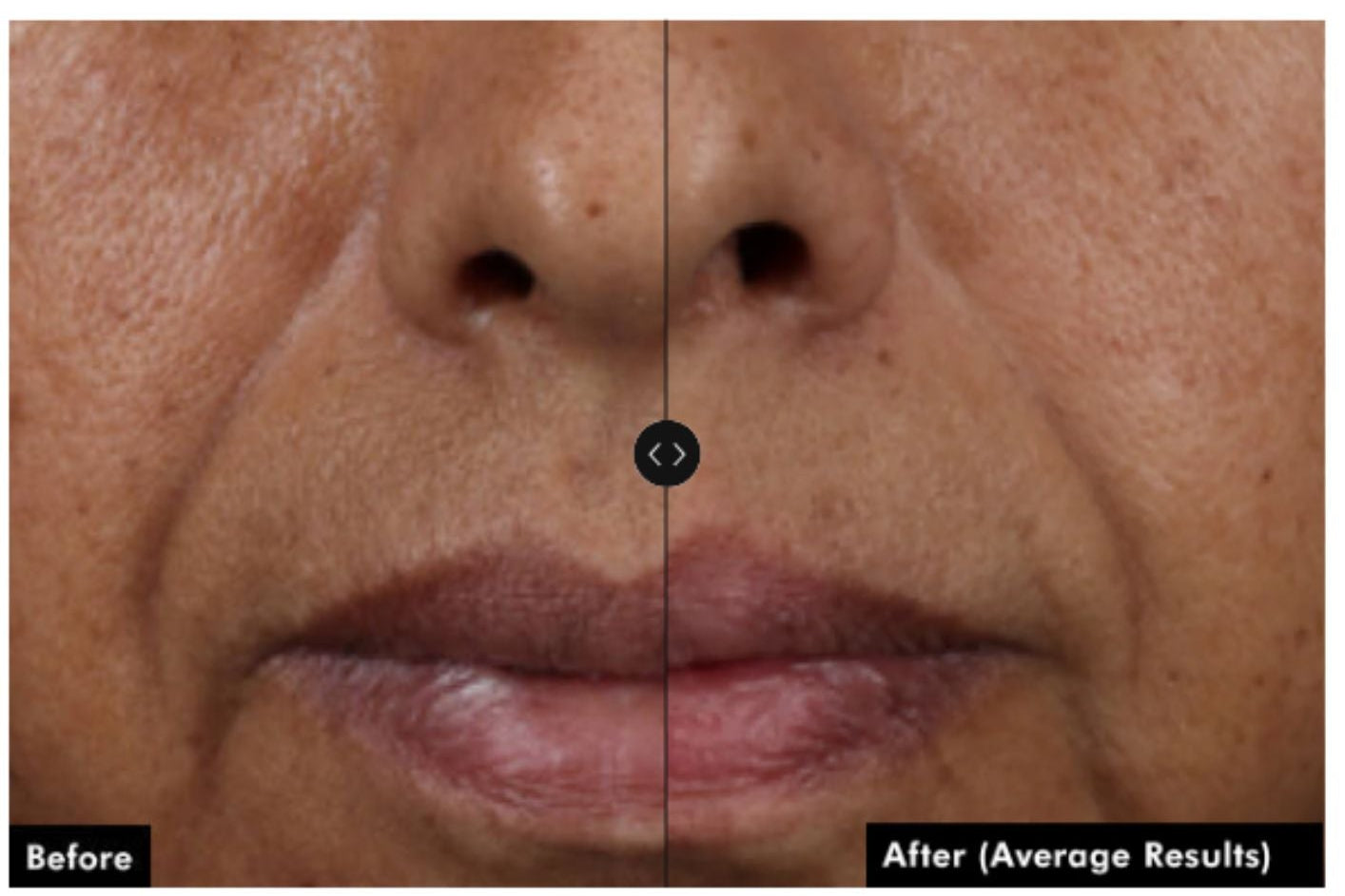 Skinceuticals H.A. Intensifier Multi-Glycan