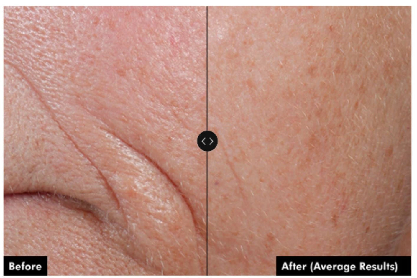 Skinceuticals CE Ferulic