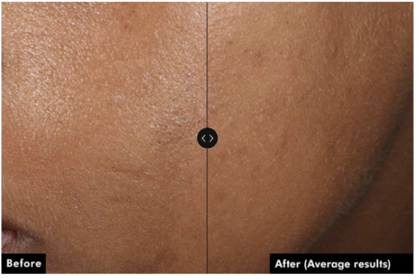 Skinceuticals Phloretin CF