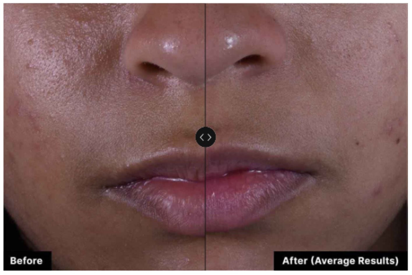 Skinceuticals Silymarin CF