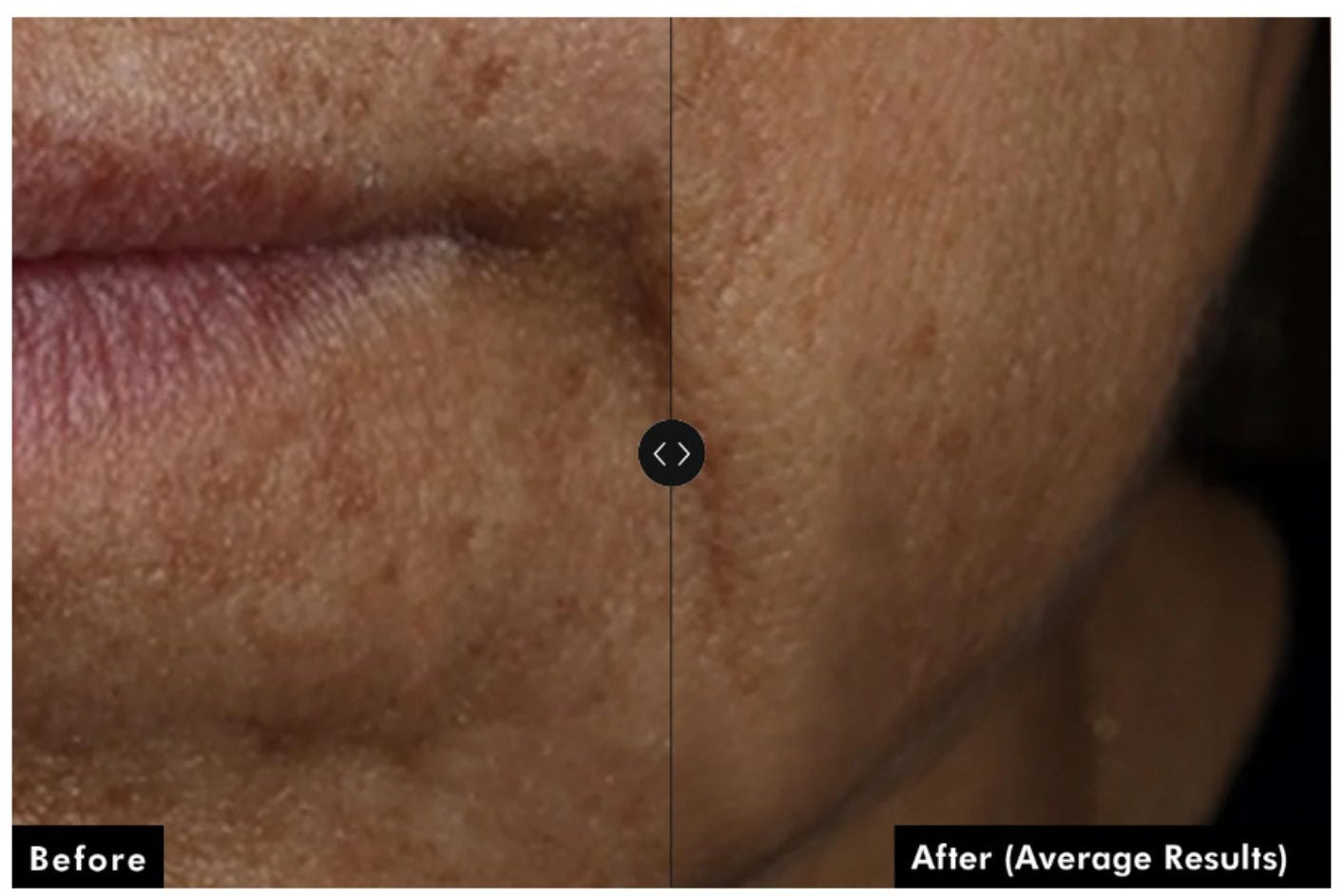 Skinceuticals A.G.E. Interrupter Ultra Serum