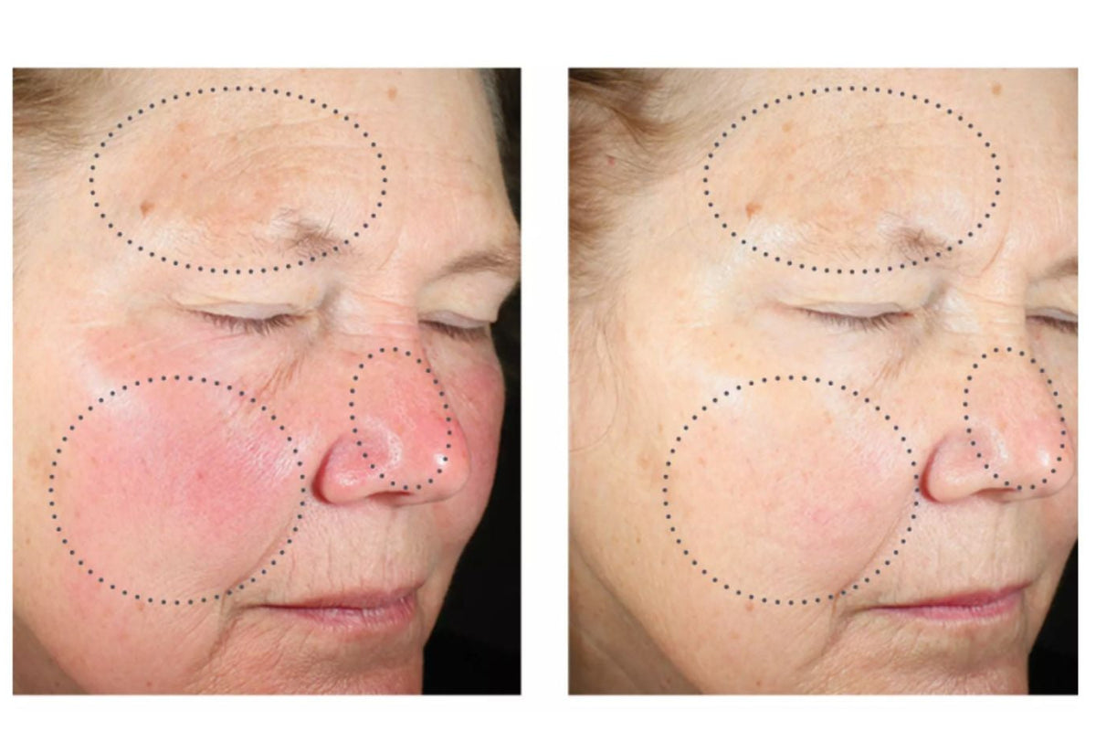 Even Tone Correcting Serum