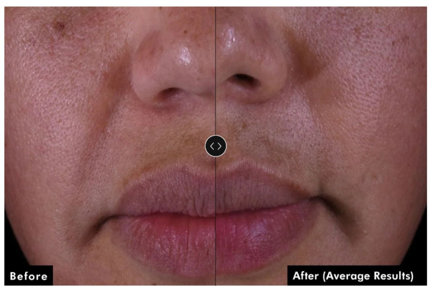 Skinceuticals P-TIOX Anti-Wrinkle Cream