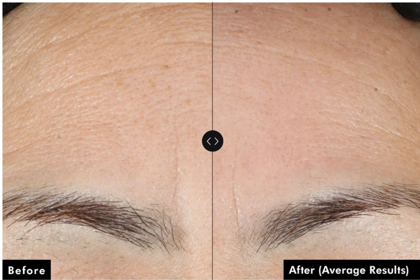 Skinceuticals Advanced RGN-6